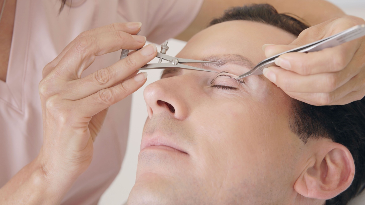 Why Eyelid Surgery Is Not Just For Mature Patients