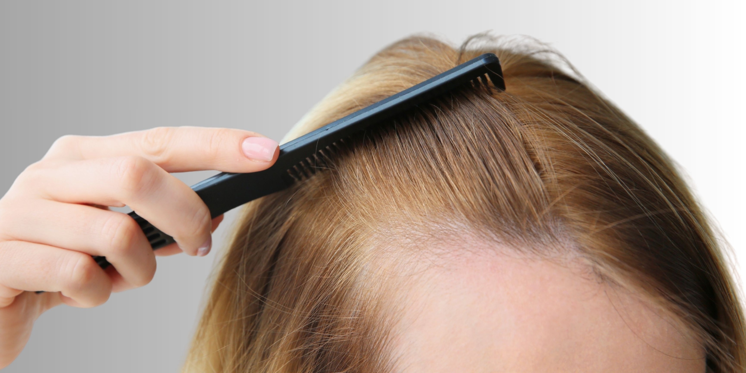 Closeup of woman brushing her thinning hair
