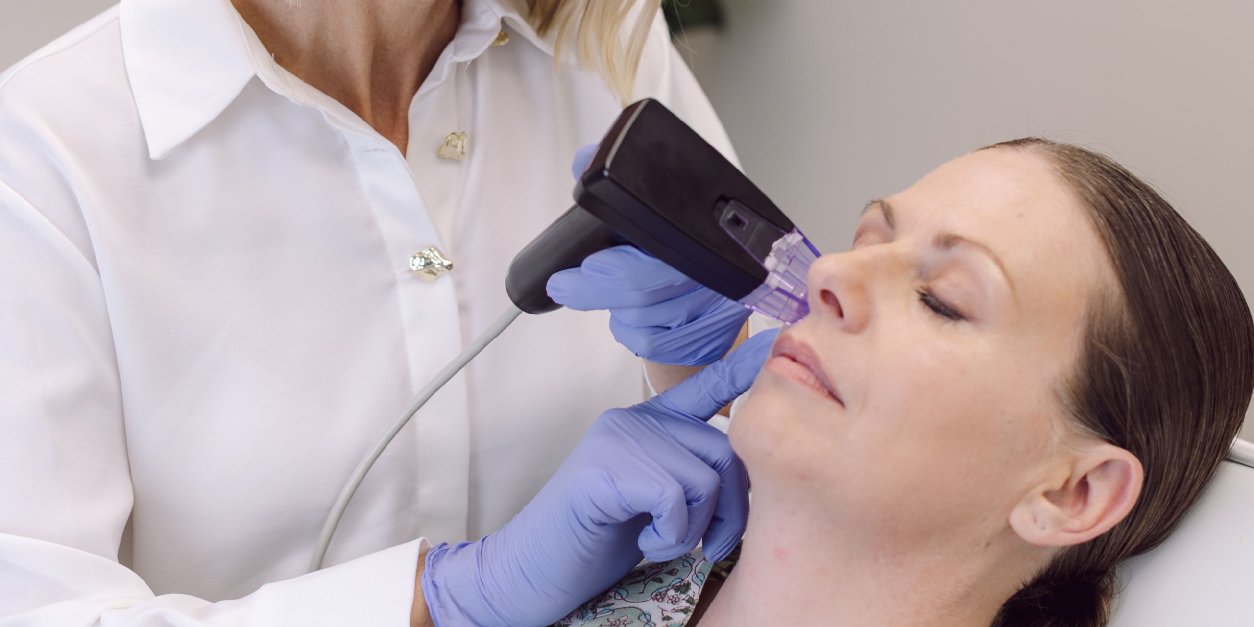 Morpheus8 treatment at Dr Nerina Wilkinson and Associates