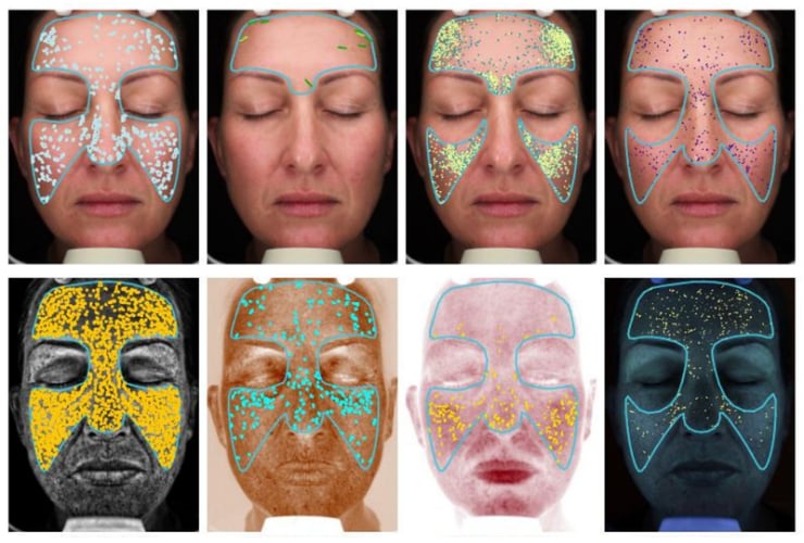 Is Your Skin Older Than You Are? Understanding Biological Skin Age